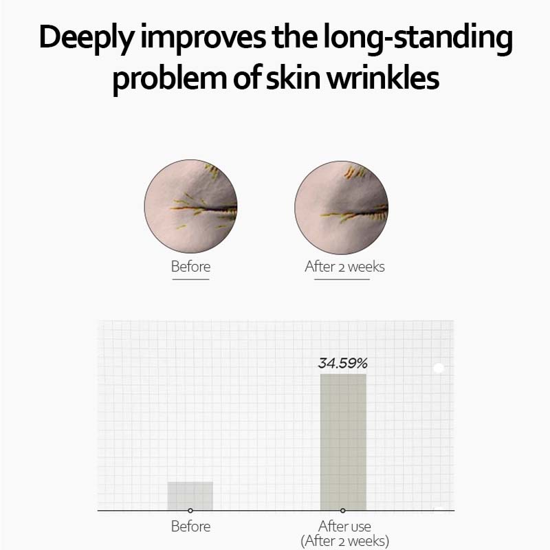 Hot Sale🌹✨ RETINOL 0.2 BOOSTING SHOT AMPOULE – The "Liquid Facelift" for Rebellious Skin ✨