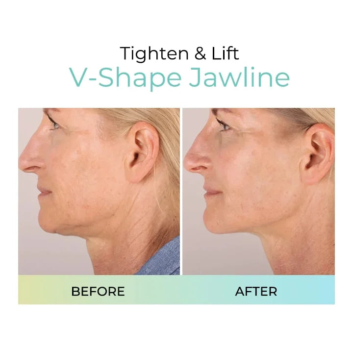 Buy 2 Get 1 FreešPlumping Anti-Wrinkle Patches
