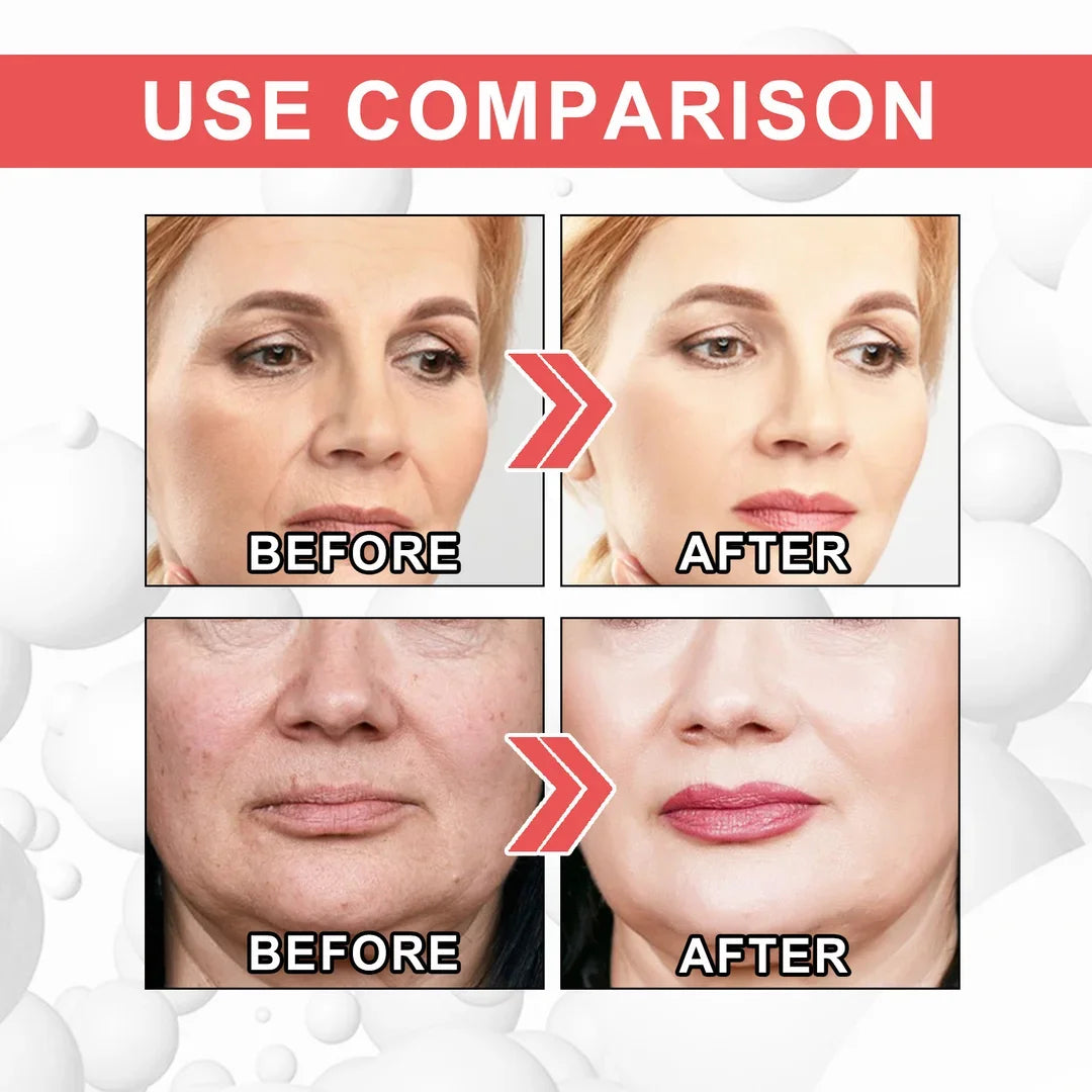 Buy 2 Get 1 Free 49% off🔥BeautyNue™ Collagen Firming Serum