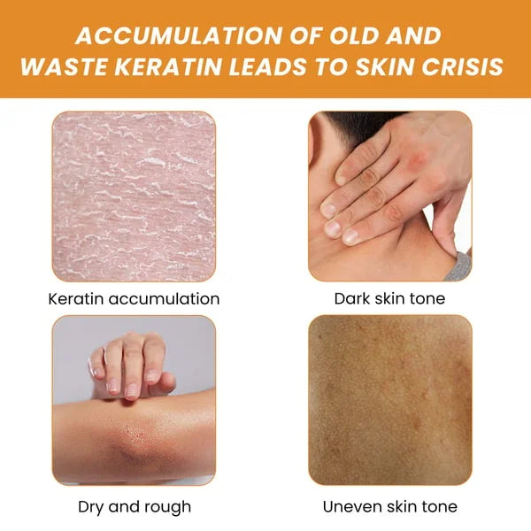 BUY MORE GET MORE FREE 49%offš„š„Whitening Exfoliating Gel