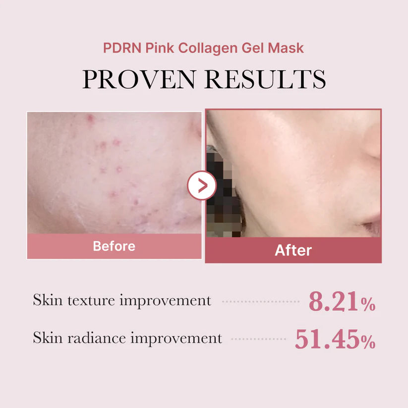 💥49% OFF! Deep Collagen Overnight Mask - Wake Up to Firm, Glowing & Wrinkle-Smoothed Skin! 💥