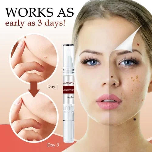 Best Sellers - Tags & Moles Removerāā10 pcs (FREE SHIPPING)