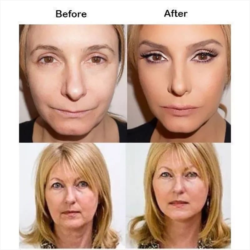 Buy 1 Get 1 Free 49%OFFđ„New Ultra Invisible Waterproof Face Lift Stickers Complete Kit