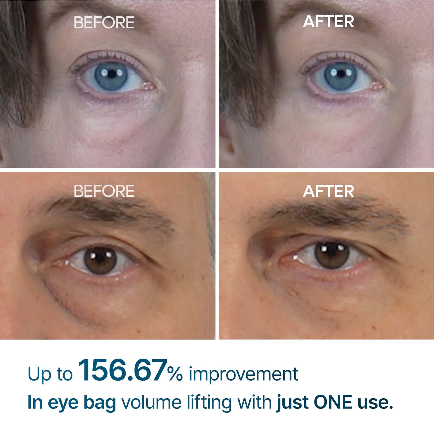 Buy 1 Get 1 Free  49%offđ„Eyebag Cream