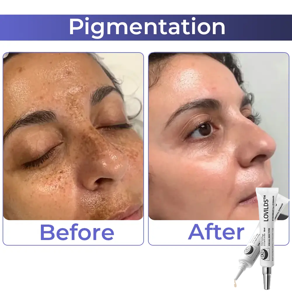 Buy 1 Get 1 Free  49%offđ„Eyebag Cream