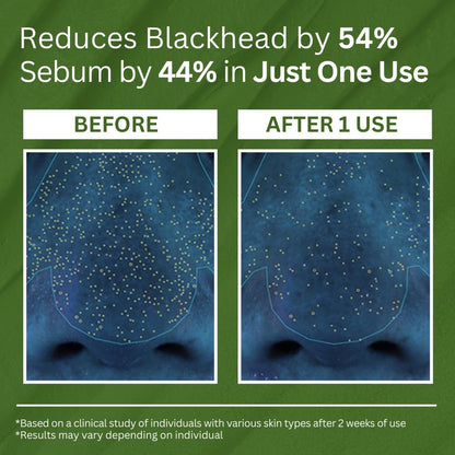 Buy 1 Get 1 Free 49%off Holy Basil Bubble Deep Mask
