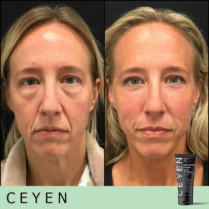 Hot Sale 49% OFF🔥Temporary Eye Cream - The Most Effective Solution To Get Rid Of Eye Bags