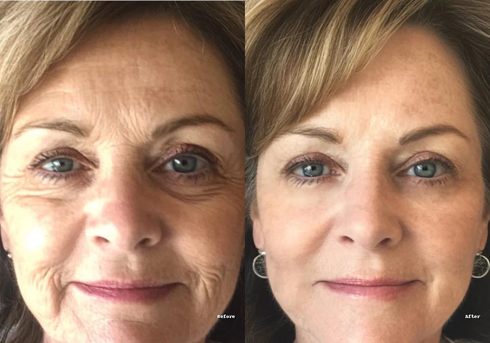 HydraBright Eye Serum